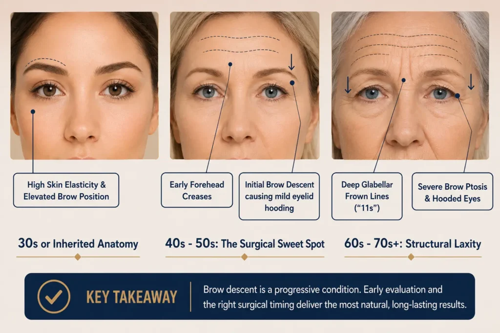 ABmedi Team Clinic’s upper-face aging timeline (A to C), demonstrating the progression from youthful tissue resilience to deep structural furrows and severe brow ptosis over the decades.